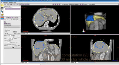 Software de calibración para la medida de dosis - PLANET® Dose - DOSIsoft - de validación / para radioterapia