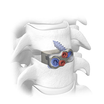 Caja intersomática cervical - Ceres®-C - SPINAL elements - vía anterior / de PEEK / con placa ósea cervical