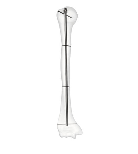 Clavo intramedular para húmero - D-Scope - Peditst - de acero inoxidable