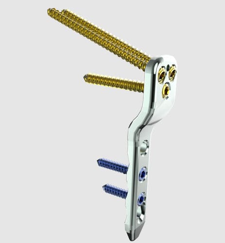 Placa de osteotomía para fémur - 31610 series - Peditst - porción proximal / bloqueada / de acero inoxidable