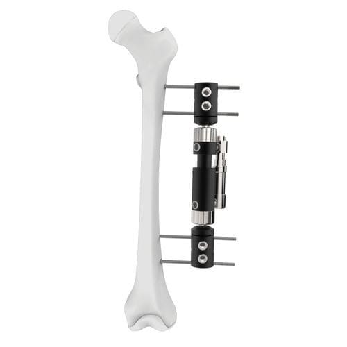 Fijador externo para fémur - DAF  - Peditst - tubular / pediátrico