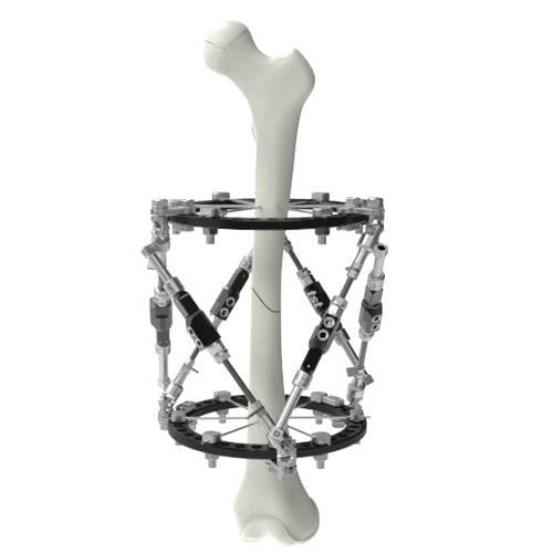 Fijador externo para fémur - Ortho-SUV® - Peditst - circular / pediátrico