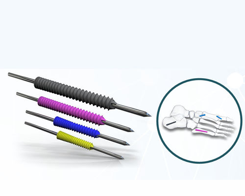 Tornillo de compresión ósea para hallux valgus - EXN02 series - Aleda Medical - canulado / sin cabeza / metálico