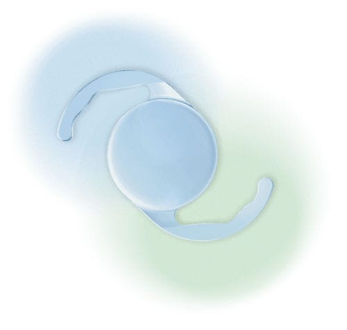 Lente intraocular monofocal - Evpl - Aurolab