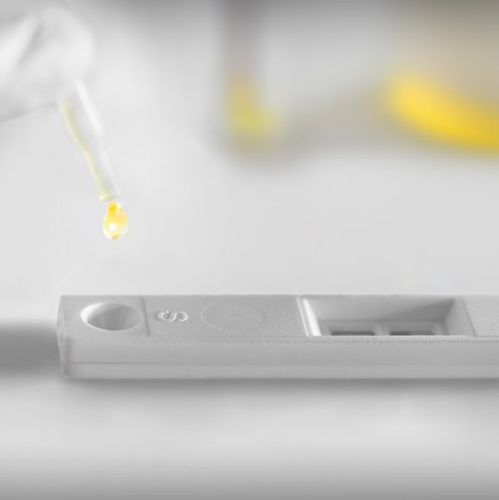 Prueba rápida de cáncer de vejiga - UBC® - IDL Biotech - de oncología / de marcadores tumorales / de orina