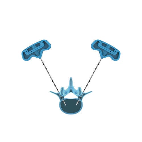 Sistema de aumento vertebral aguja - PVP - Hicren Zhejiang Medtech - para vertebroplastia percutánea