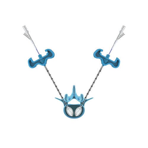 Sistema de aumento vertebral globo - PKP - Hicren Zhejiang Medtech - para cifoplastia percutánea