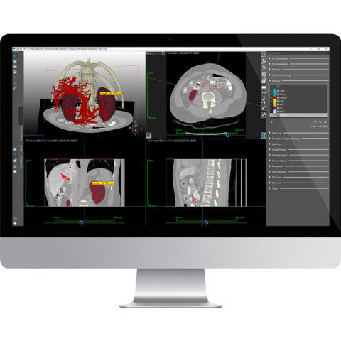 Software de análisis - Medip - MEDICALIP Co., Ltd. - de medición / de impresión 3D / de modelado