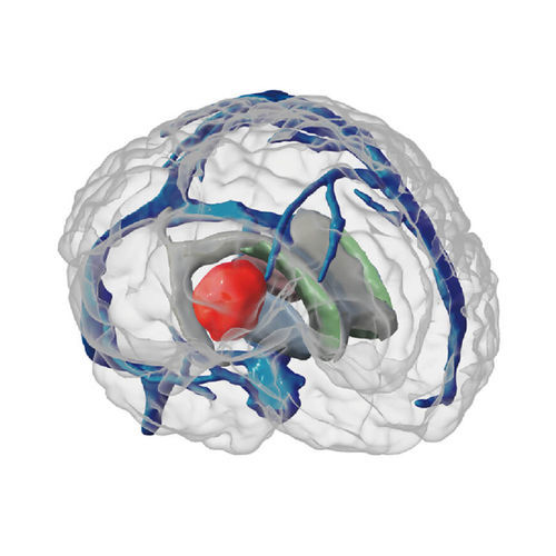 Fantoma de prueba para radiocirugía - ANATDEL - MEDICALIP Co., Ltd. - para radiología / de cerebro