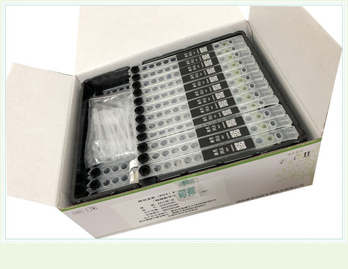 Kit de prueba para enfermedades cardiovasculares - 0007HC - Beijing O&D Biotech Co., Ltd. - de quinasa creatina / de suero / CLIA