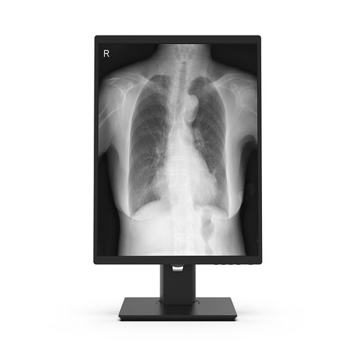 Monitor médico - 21X3M-I3 - KTC Medical Solutions - quirúrgico / de diagnóstico / de radiología