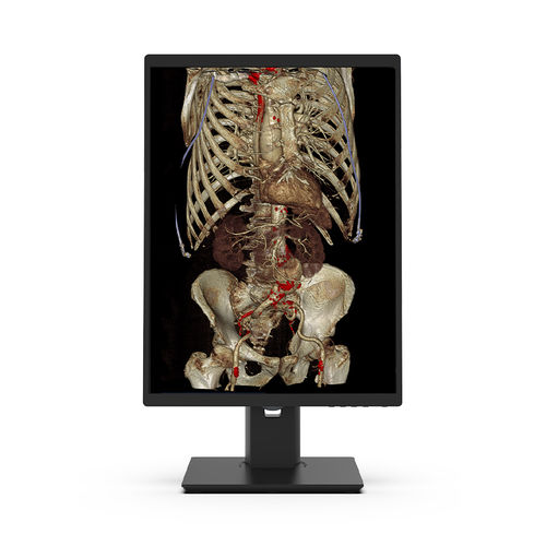 Monitor médico - 21X3C-I3 - KTC Medical Solutions - de diagnóstico / de radiología / 21.3"