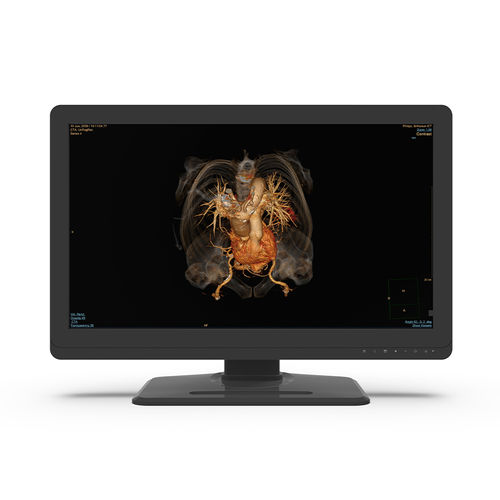 Monitor médico - 27X4C-I0 - KTC Medical Solutions - de diagnóstico / de radiología / QHD