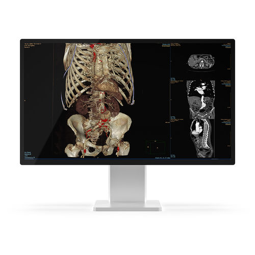 Monitor médico - 27X4C-K1 - KTC Medical Solutions - de diagnóstico / de radiología / QHD