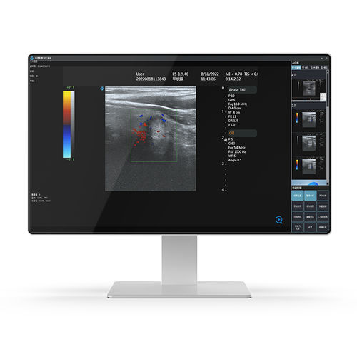 Ordenador médico Intel® Core i7 - 24H32 - KTC Medical Solutions - para carro informático / para centro sanitario / para imagen médica