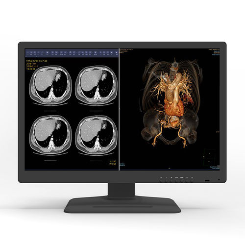 Monitor médico - 30X6C - KTC Medical Solutions - de diagnóstico / de radiología / 30"