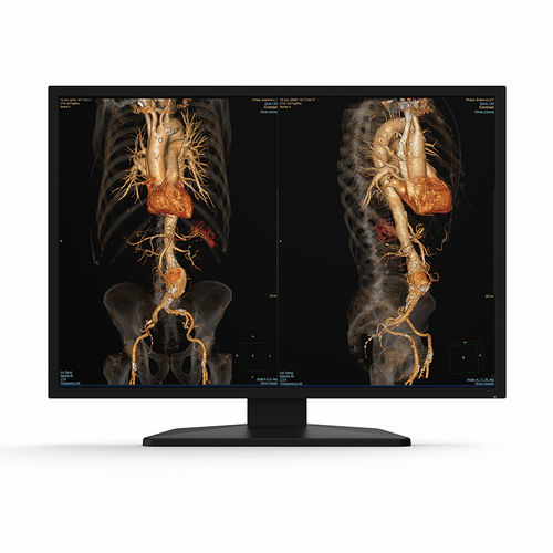 Monitor médico - 31X12C - KTC Medical Solutions - de diagnóstico / de radiología / 4K