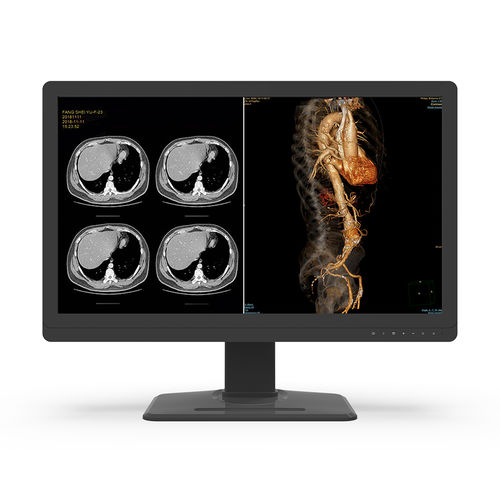 Monitor médico - S32X8C-I0 - KTC Medical Solutions - de diagnóstico / de radiología / 3.840x 2.160
