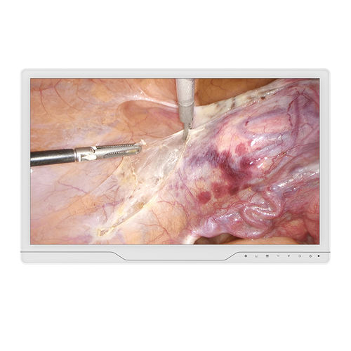 Monitor médico - 22A30 - KTC Medical Solutions - para endoscopia / 1920 x 1080 / 21,5"