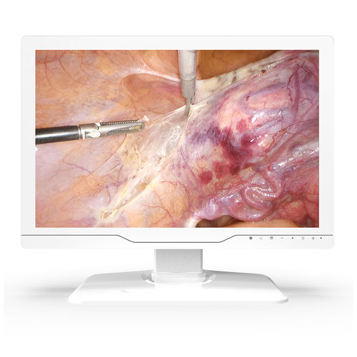 Monitor médico - 24A30 - KTC Medical Solutions - para sala de operaciones / para endoscopia / 1920x1200