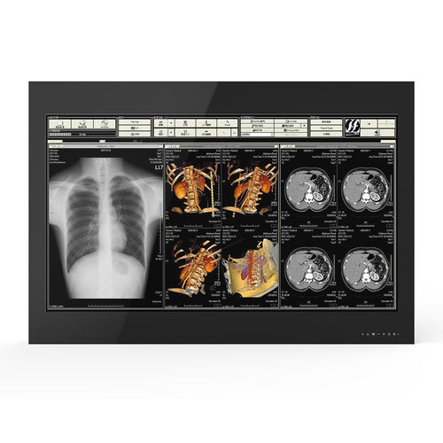Monitor médico - 55H90 - KTC Medical Solutions - para sala de operaciones / 3.840x 2.160 / 55"