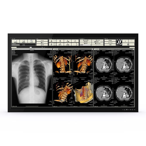Monitor médico - 65H90 - KTC Medical Solutions - para sala de operaciones / 3.840x 2.160 / 65"
