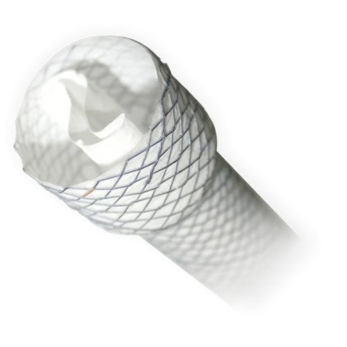 Stent esofágico - BRAVO - MITRA Industries - de metal