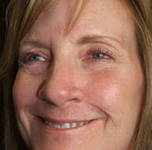 Prótesis estética esterna nasal - Medical Art Prosthetics - parcial / para adulto