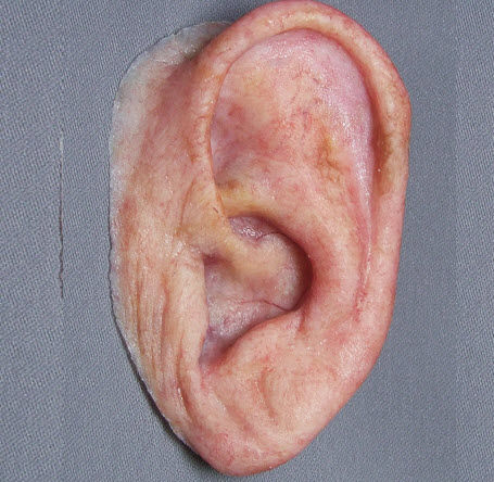 Prótesis estética esterna auricular - Medical Art Prosthetics - para adulto