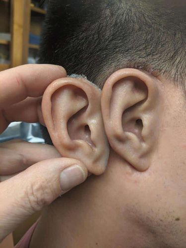 Prótesis estética esterna auricular - Permanent - Medical Art Prosthetics - parcial / para adulto