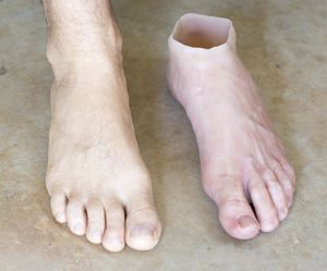 Prótesis estética esterna para pie - Northern Prosthetics - para adulto