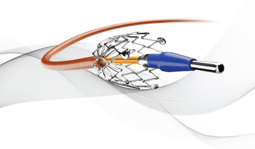 Stent periférico - DYLANO - USM Healthcare Medical Devices Factory