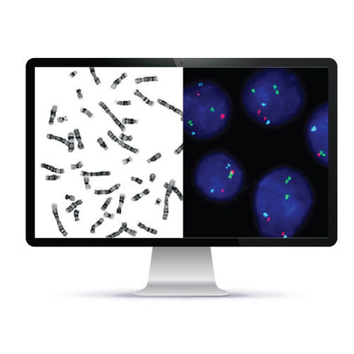 Sistema de imagen celular automatizado - CytoPower™ - Applied Spectral Imaging - de laboratorio / de citogenética / FISH
