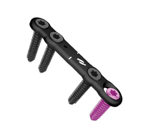 Placa de osteotomía para antepié - Airlock® - novastep - bloqueada / metálica