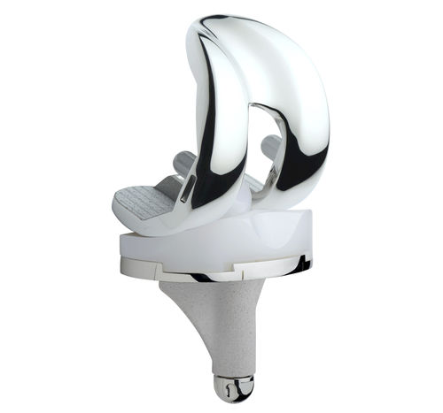 Prótesis de rodilla tricompartimental - ANATOMIC® - Amplitude Surgical - de deslizamiento con estabilización posterior / de platillo fijo