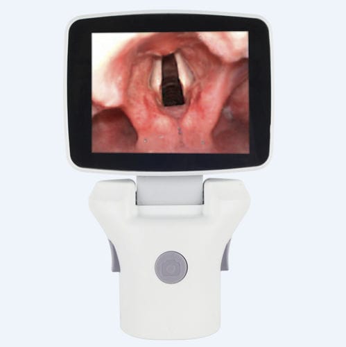 Videolaringoscopio con monitor de vídeo integrado - TL-100V-Ⅱ - Shenzhen Tianlang Medical Equipment - con hoja