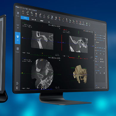 Software médico - SmartV-ENT - LargeV Instrument - de implantología dental / para imágenes médicas / de ORL