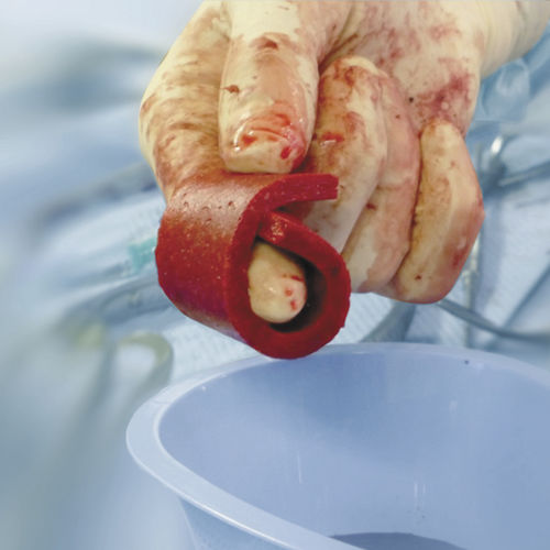 Sustituto óseo xenotransplante - Cerasorb® Foam - Curasan - para cirugía ortopédica / maleable
