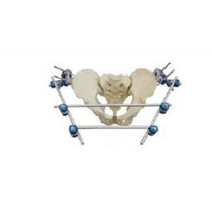 Fijador externo de pelvis - T8012 - Orthopromed - tubular / para adulto