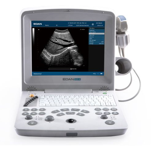 Ecógrafo portátil - DUS60 - JFB International - para ecografía ginecológica y obstétrica / para ecografía urológica / para ecografía musculoesquelética