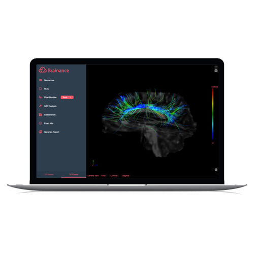 Software de análisis de imágenes - Brainance MD  - Advantis Medical Imaging - para informes / de visualización 3D / de visualización DICOM