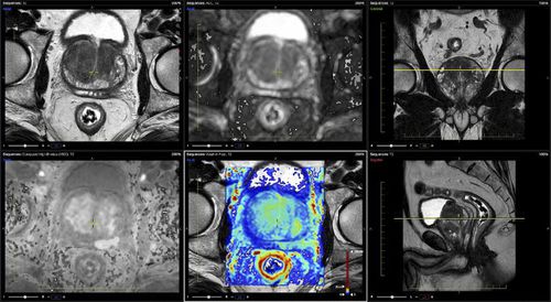Software de análisis - Advantis Medical Imaging - para informes / visualizador / para IRM