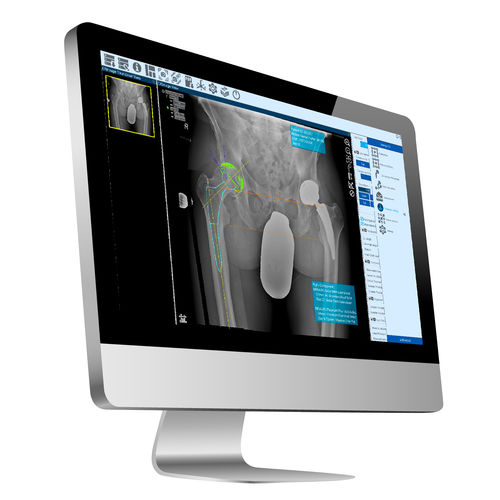 Software visualizador - ZedView2.5D - LEXI Co. - de planificación / de tratamiento / de importación
