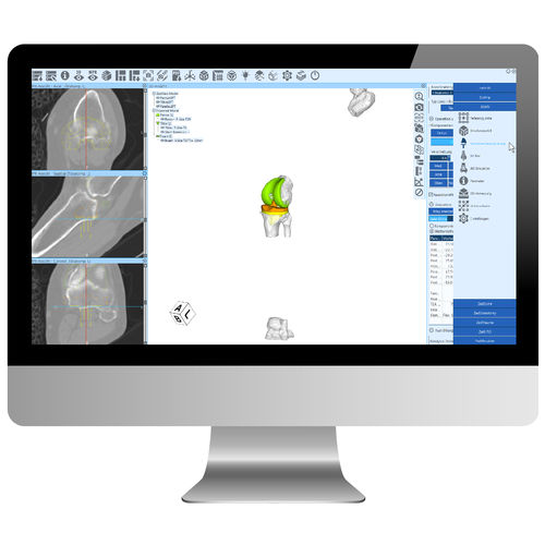 Software de planificación - ZedView - LEXI Co. - de hospital / TDM / para cirugía de la rodilla