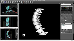 Software visualizador - ZedView - LEXI Co. - de planificación / de importación / médico