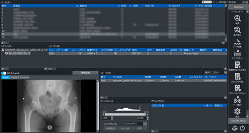 Software visualizador - ZedView2.5D  - LEXI Co. - de planificación / de tratamiento / de importación
