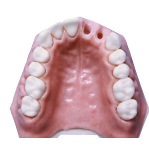 Modelo anatómico de maxilar - DM – 112  - Selmodels SL