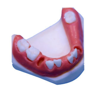 Modelo anatómico de mandíbula - DM – 116 - Selmodels SL - para cirugía dental