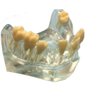 Modelo anatómico de mandíbula - DM – 2002 - Selmodels SL - para cirugía dental / de implantología / transparente