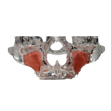 Modelo anatómico de maxilar - 3D-111-T - Selmodels SL - transparente